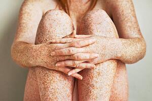 Art Photography Freckled girls hands, arms and legs, close up, Dimitri Otis, (40 x 26.7 cm)